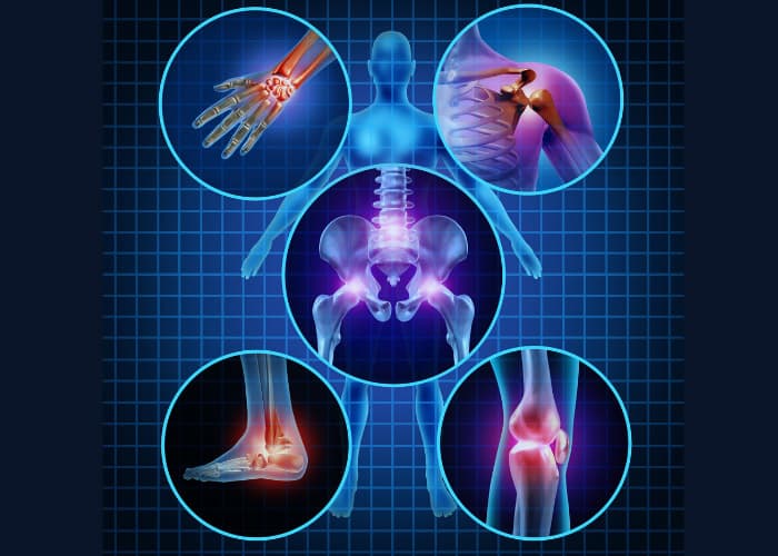 Understanding The Different Types Of Arthritis Arlington Cleburne Fort Worth Tx 9753