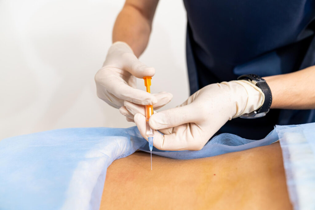Nerve Block Options