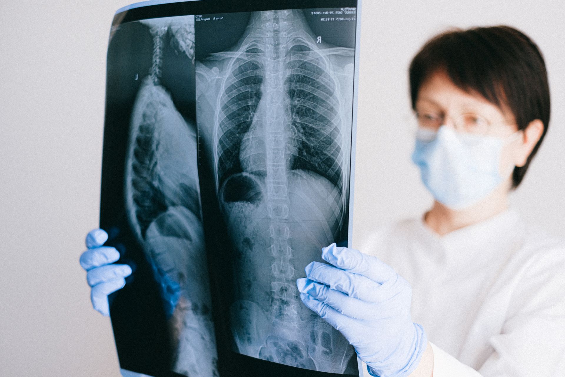 Questioning Spinal Fusion in Weatherford When Back Pain Persists
